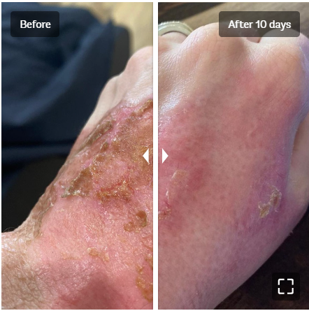 Vivier V-STAT Advanced Repair Gel