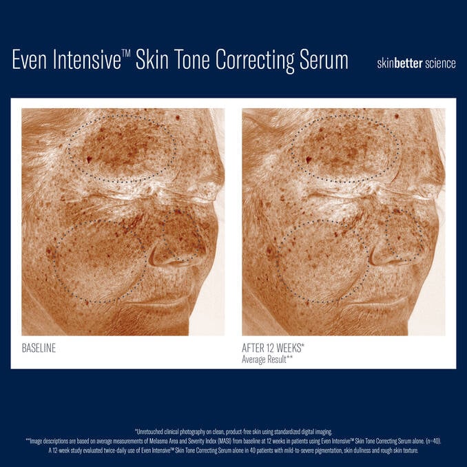SkinBetter Even Intensive Skin Tone Correcting Serum