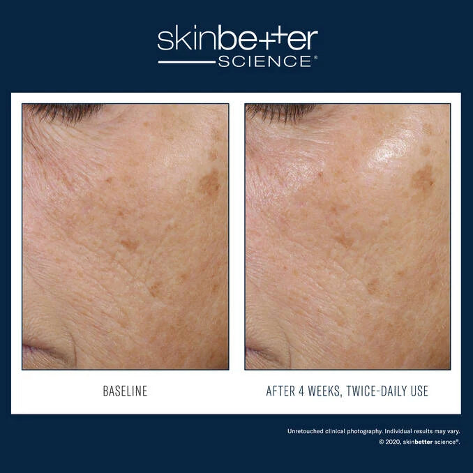 SkinBetter Trio Rebalancing Moisture Treatment