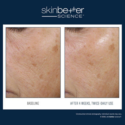 SkinBetter Trio Rebalancing Moisture Treatment