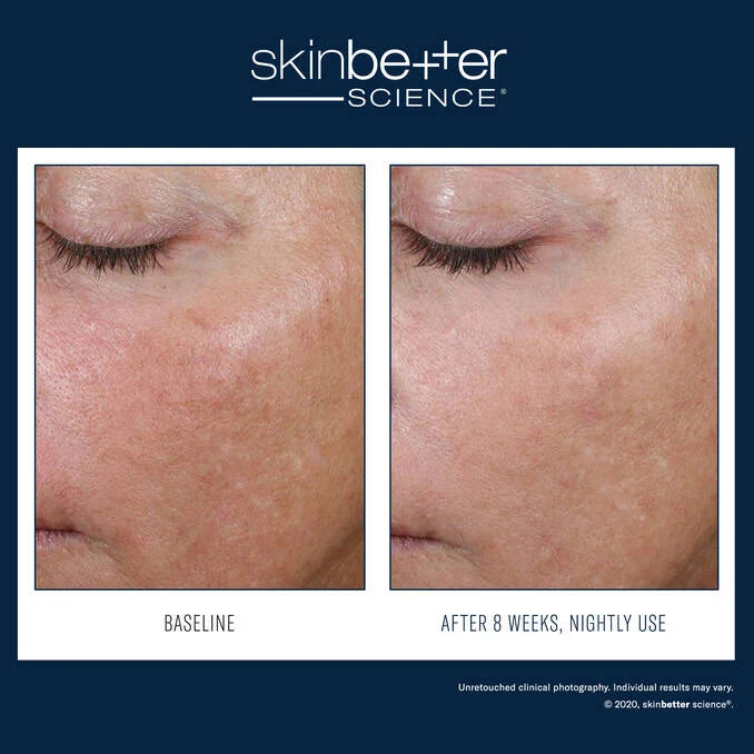 SkinBetter AlphaRet Overnight Cream