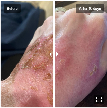Vivier V-STAT Advanced Repair Gel