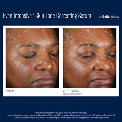 SkinBetter Even Intensive Skin Tone Correcting Serum