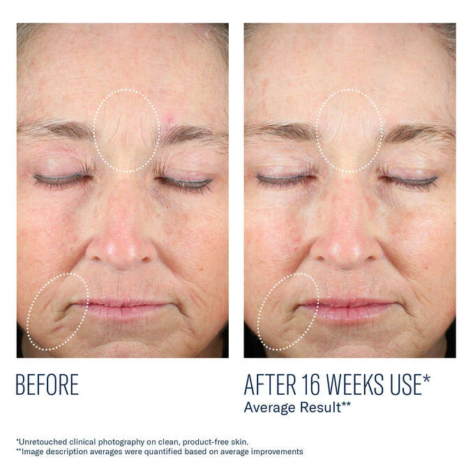SkinBetter Mystro Revive Renewing Serum