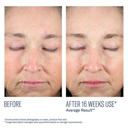 SkinBetter Mystro Revive Renewing Serum