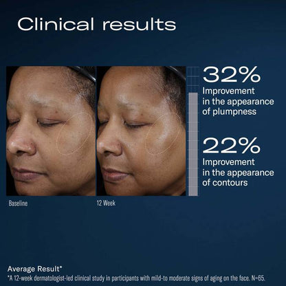 SkinBetter Ampra Volumizing Macro HA Serum